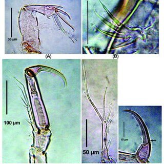 Development of dicot embryo