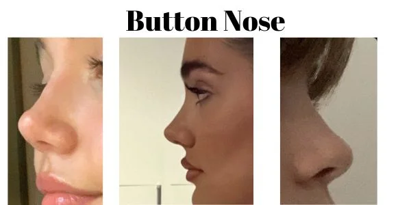 Button Nose