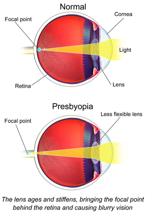 byopia/biopia