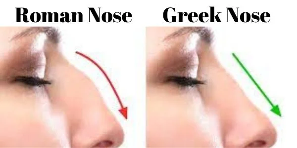 Roman Nose