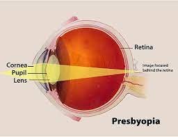 Byopia/biopia